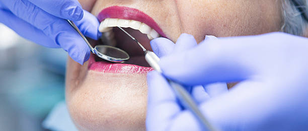 Best Emergency Root Canal Treatment in Trucksville, PA